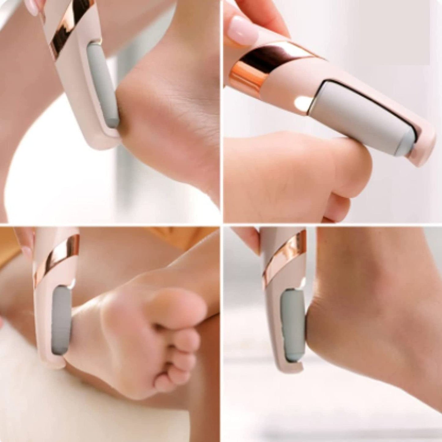 Rechargeable Pedicure Tool - Ultimate Foot Callus Remover