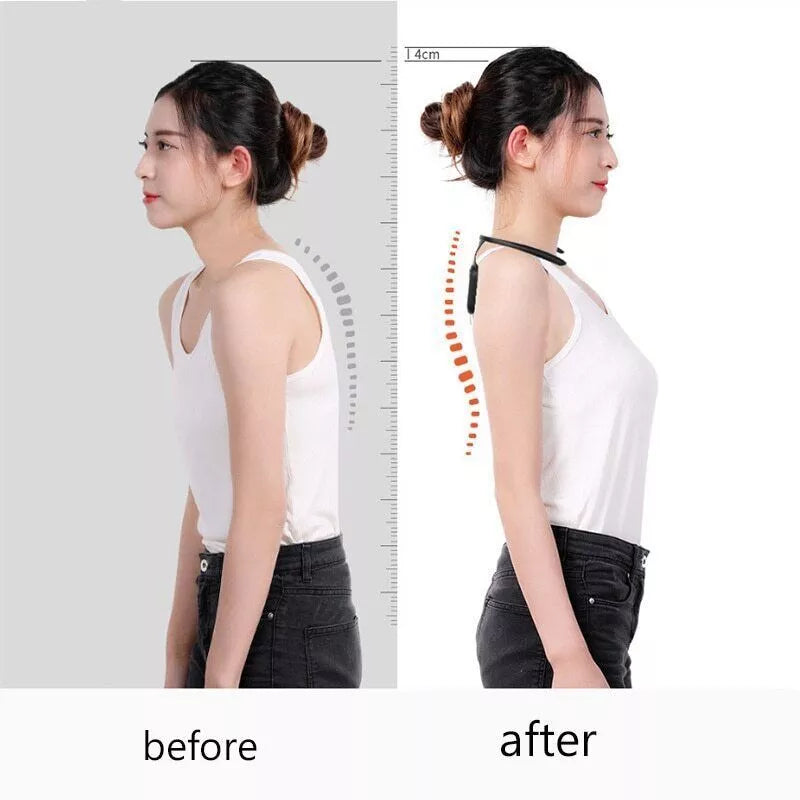 Smart Posture Corrector